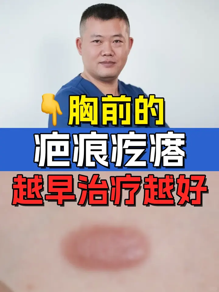 胸前疤痕疙瘩,早期治疗效果越! - 知乎
