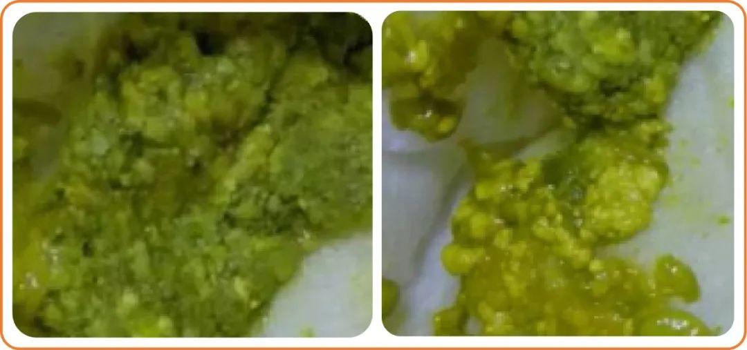 注意!宝宝便秘、奶瓣、油状便、绿便、腹泻……都可能是因为奶粉中的TA消化吸收不好 - 知乎