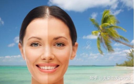 皮肤为什么会被晒黑? - 知乎