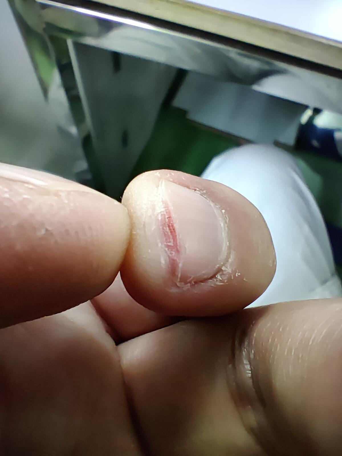 为什么手指甲缝里摸起来很爽? - 知乎