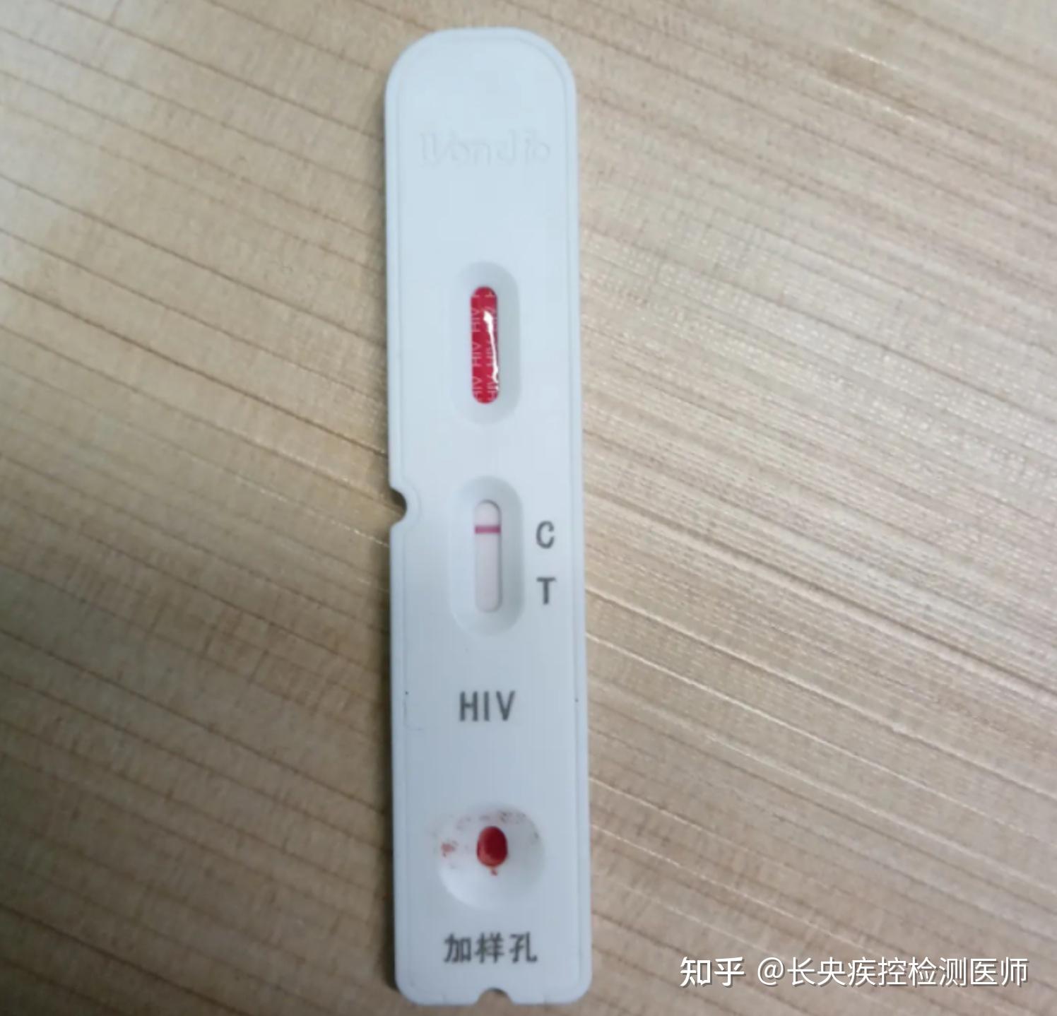 万孚HIV试纸会不会因为血量不够导致结果不准? - 知乎