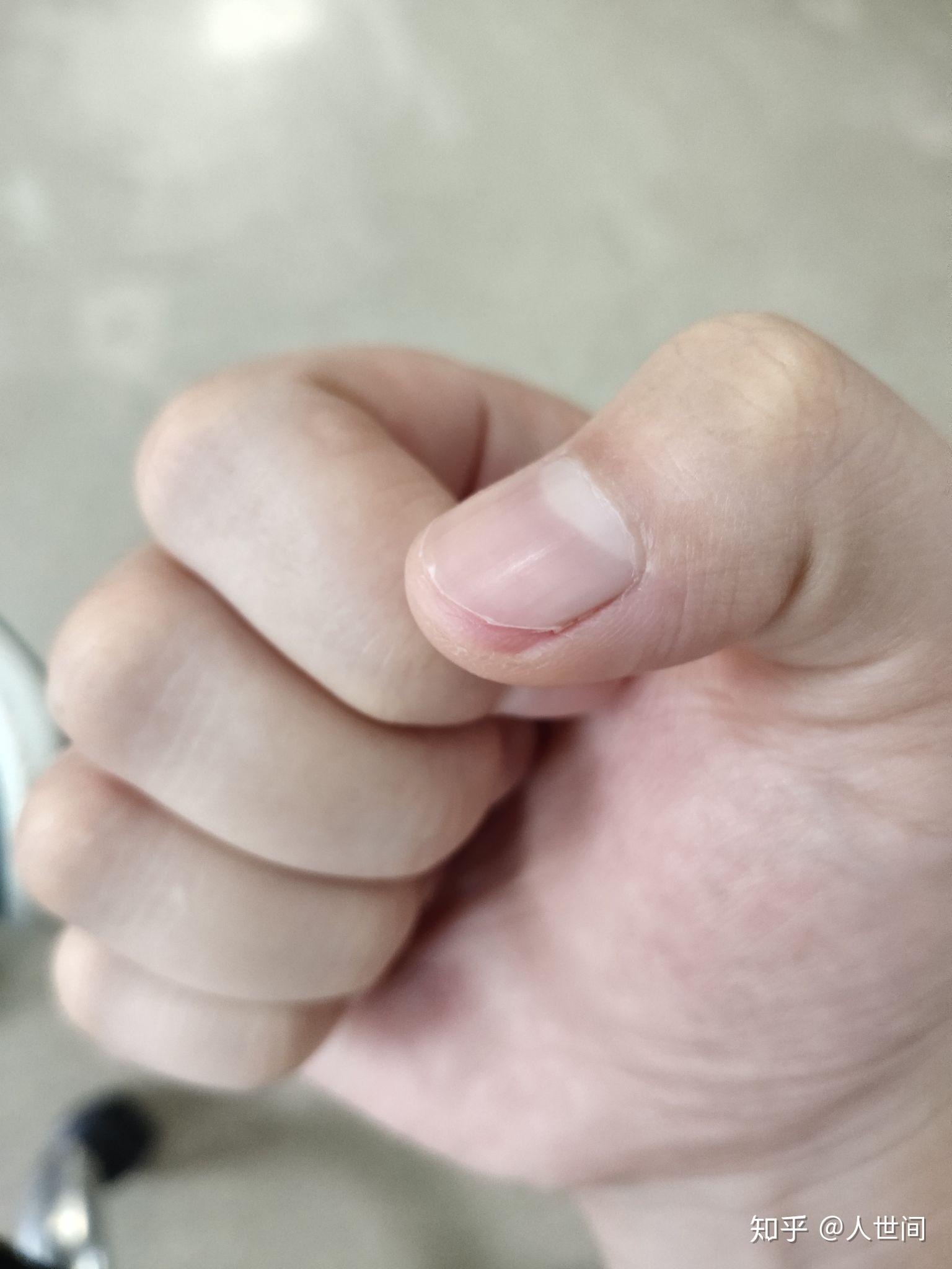 手指甲剪的很短是什么体验