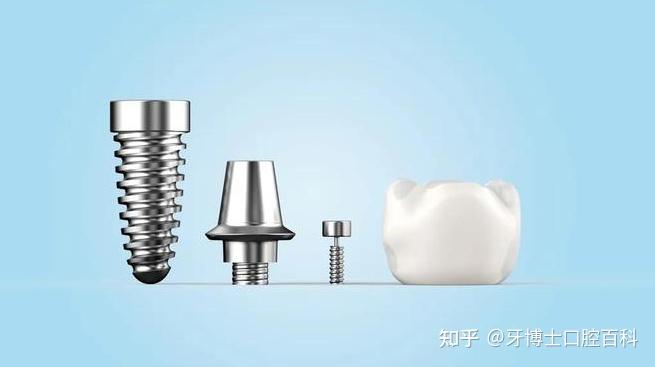 该选士卓曼straumann哪个系统种植牙