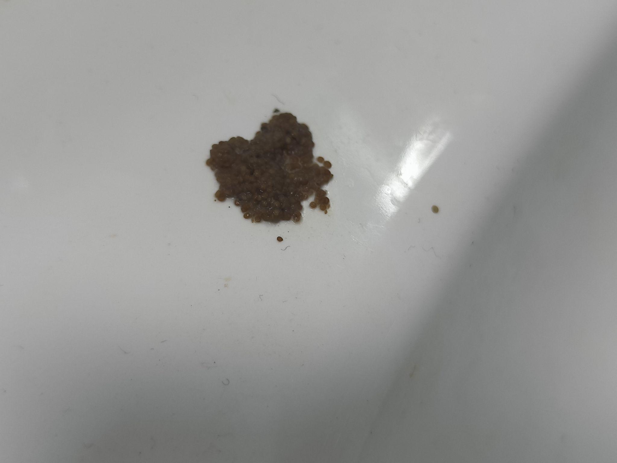 家中出现棕色像芝麻一样的小虫卵?