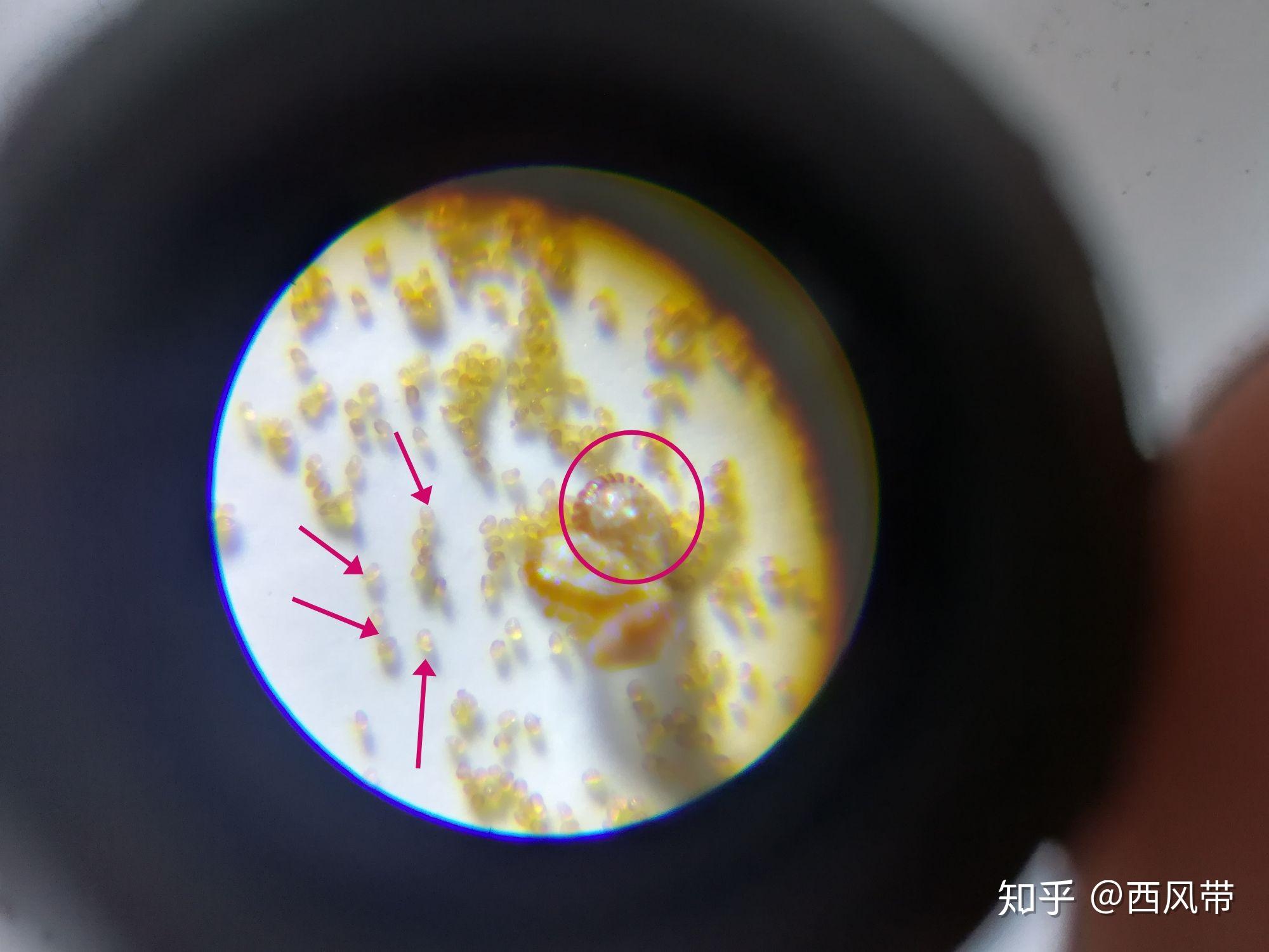 这是蕨类的孢子,为什么在十倍镜下像是一串葡萄,是多个孢子的聚合体?