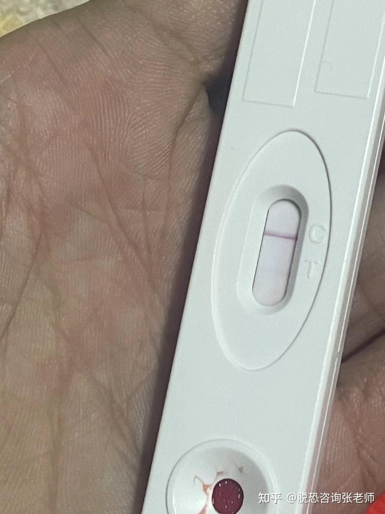 hiv试纸包埋线是什么样的?