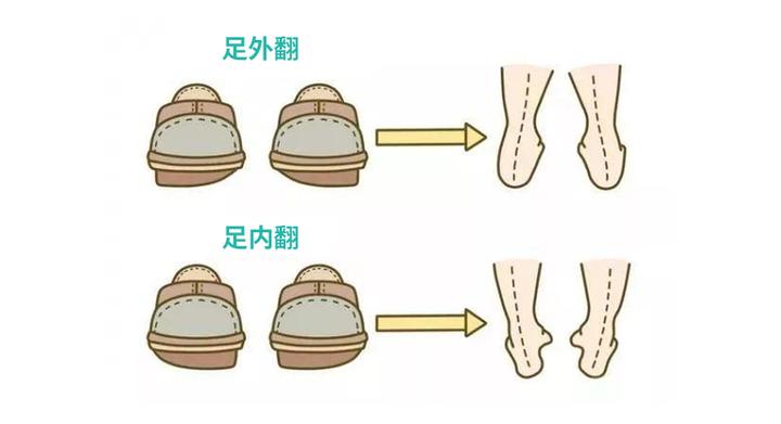 咦?你的鞋底会说话!鞋底的不同磨损,到底暗示着什么? - 知乎