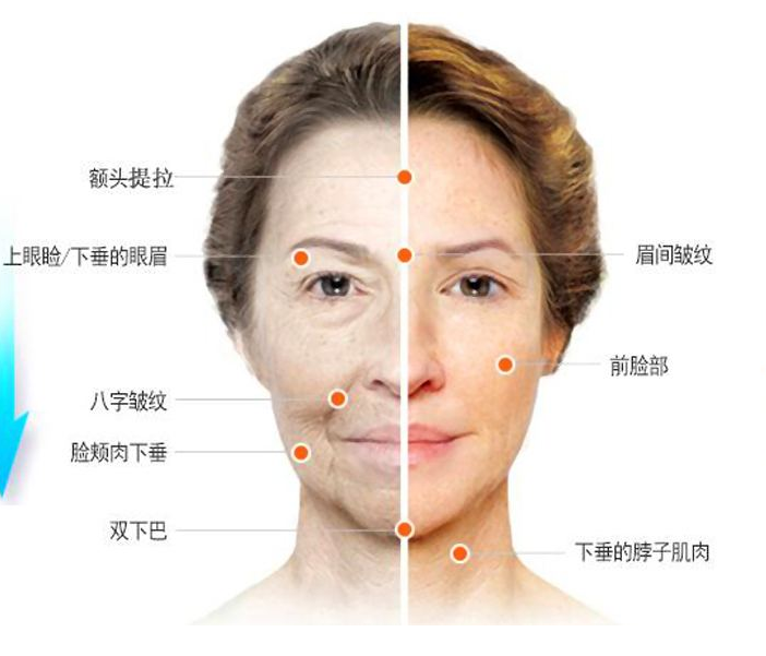 比“发福”更可怕的是“发腮”,你了解吗? - 知乎