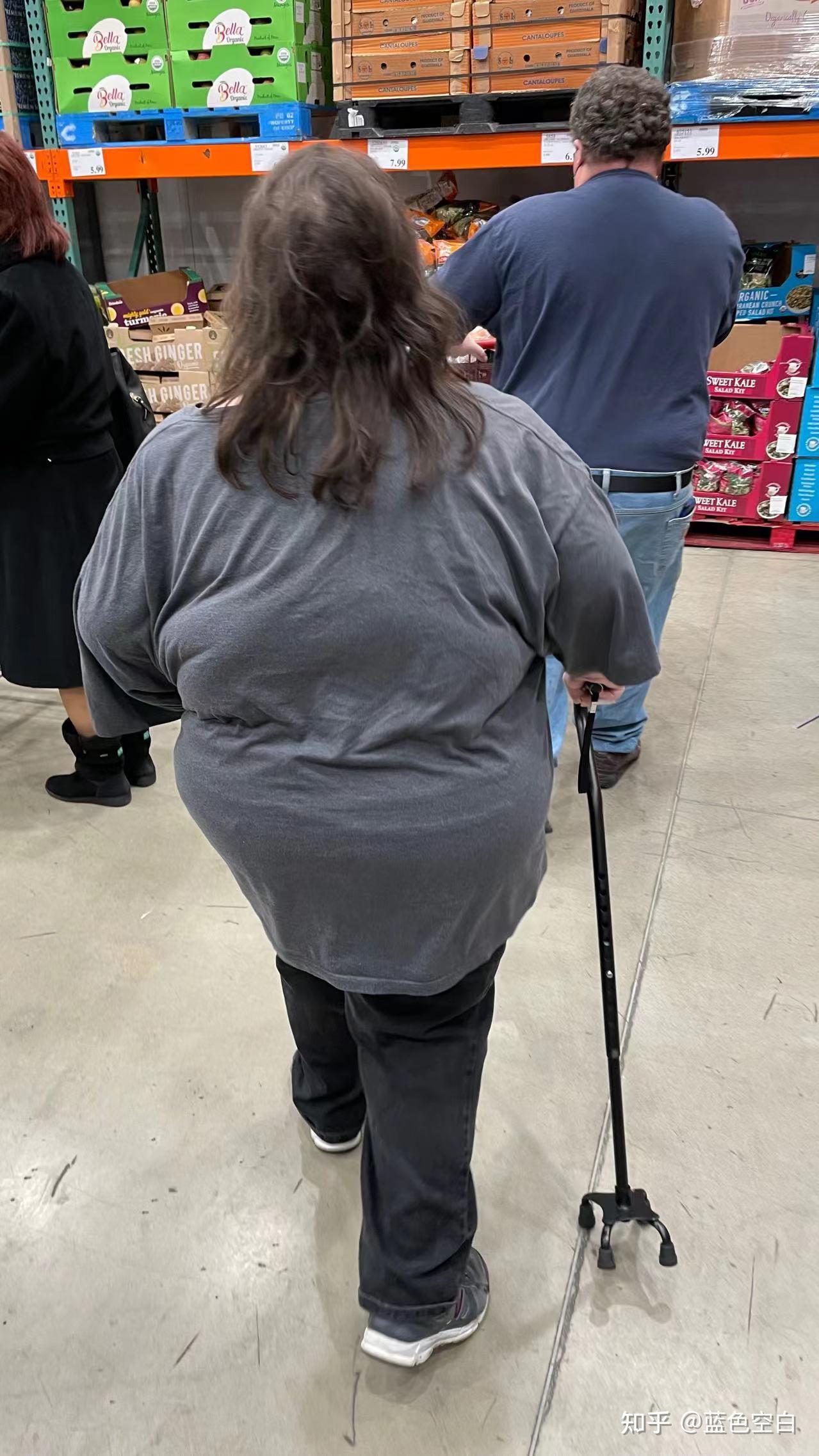 美国人肥胖严重的根本原因是什么? - 知乎