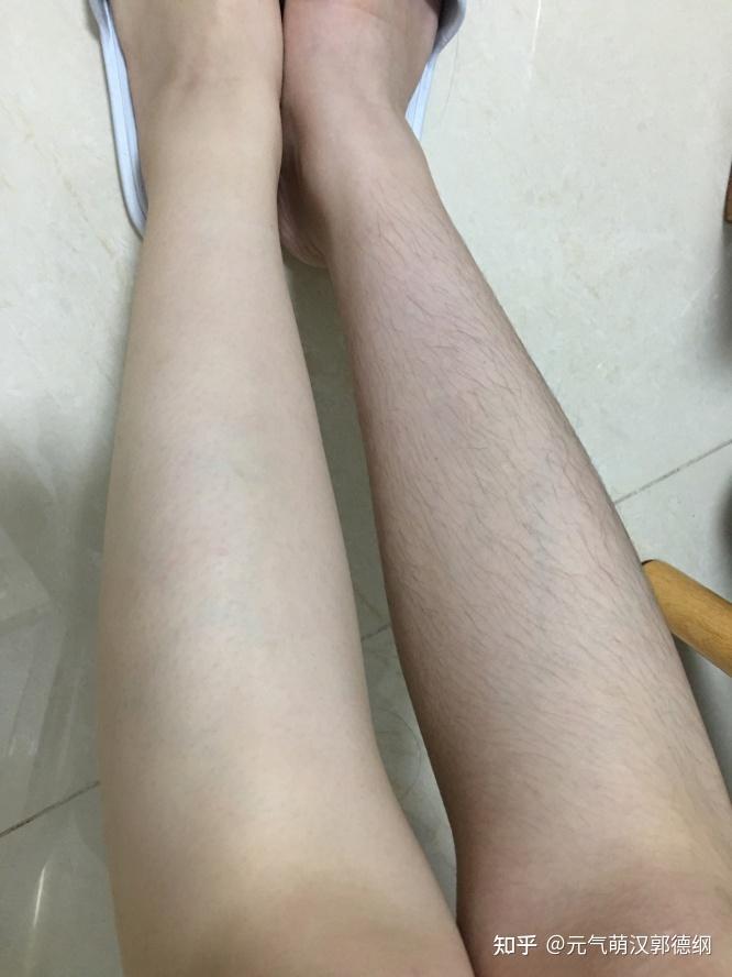 女生可以用刀片割手毛腿毛吗