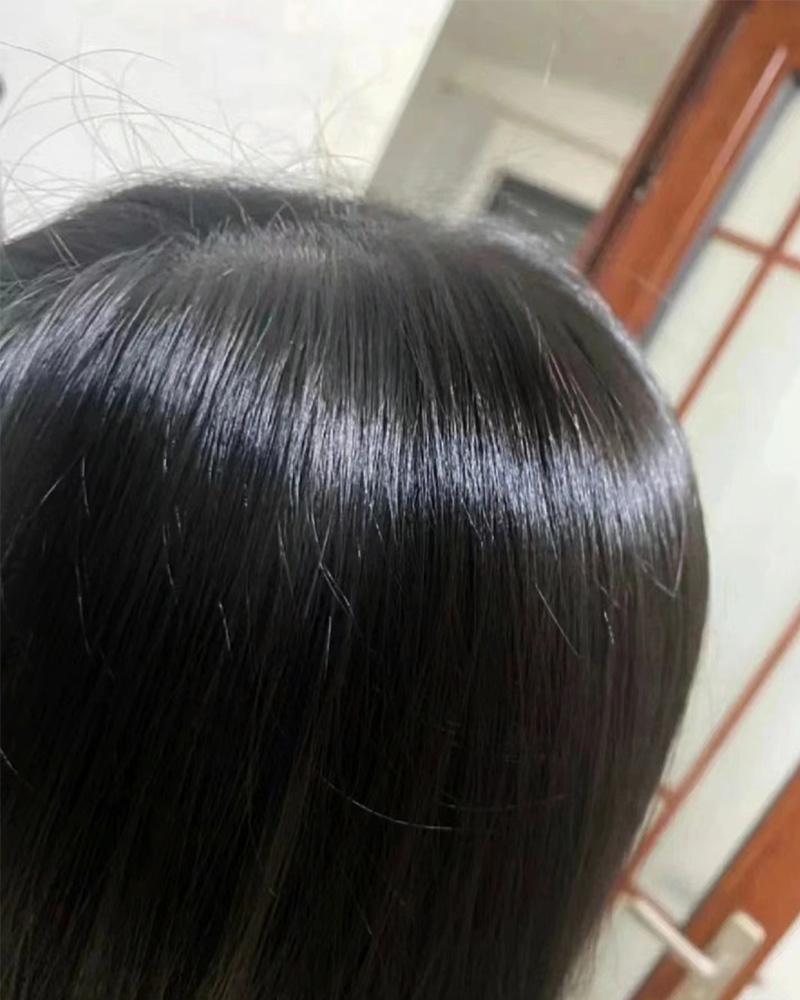 头上有螨虫的4个表现百科在线