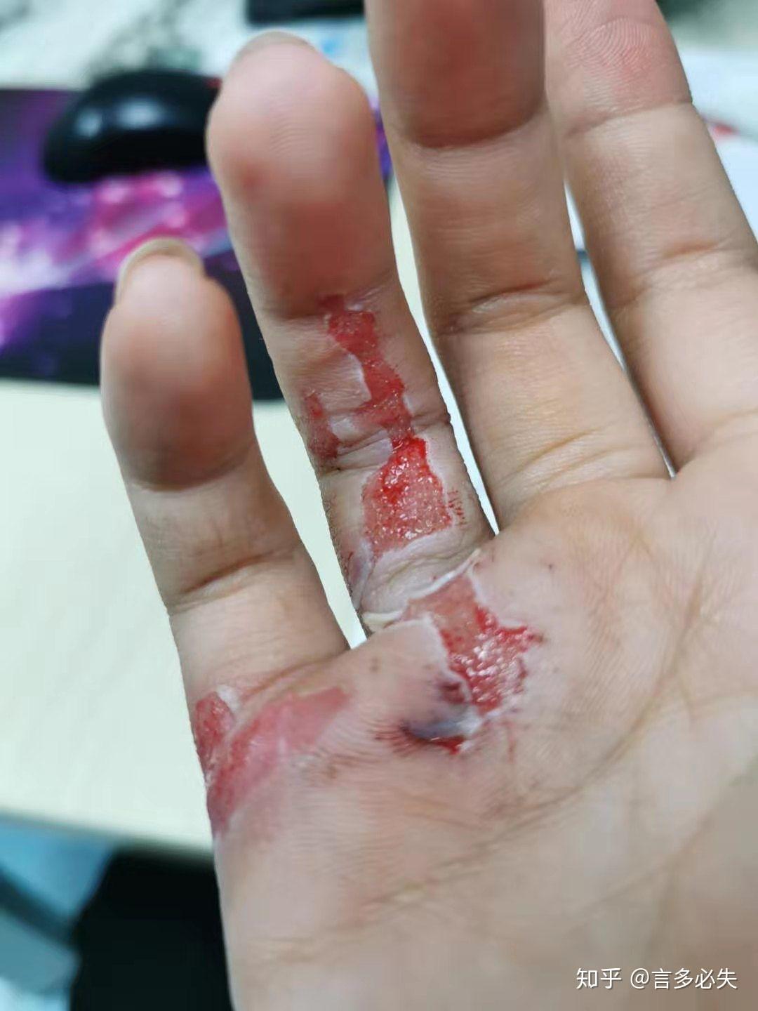 请问这是轻伤还是轻微伤?