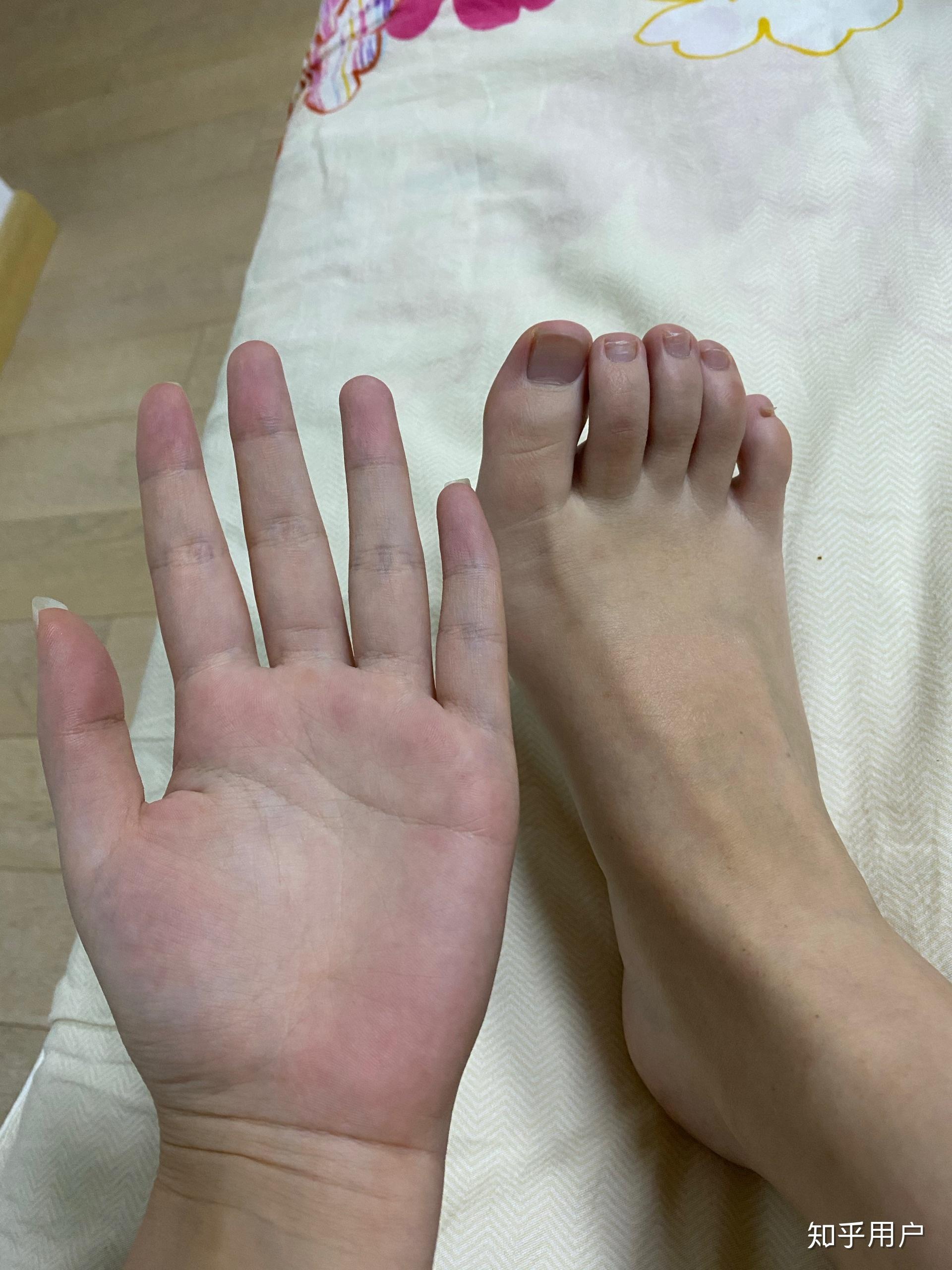 女生拥有一双罗马脚是什么体验? - 知乎