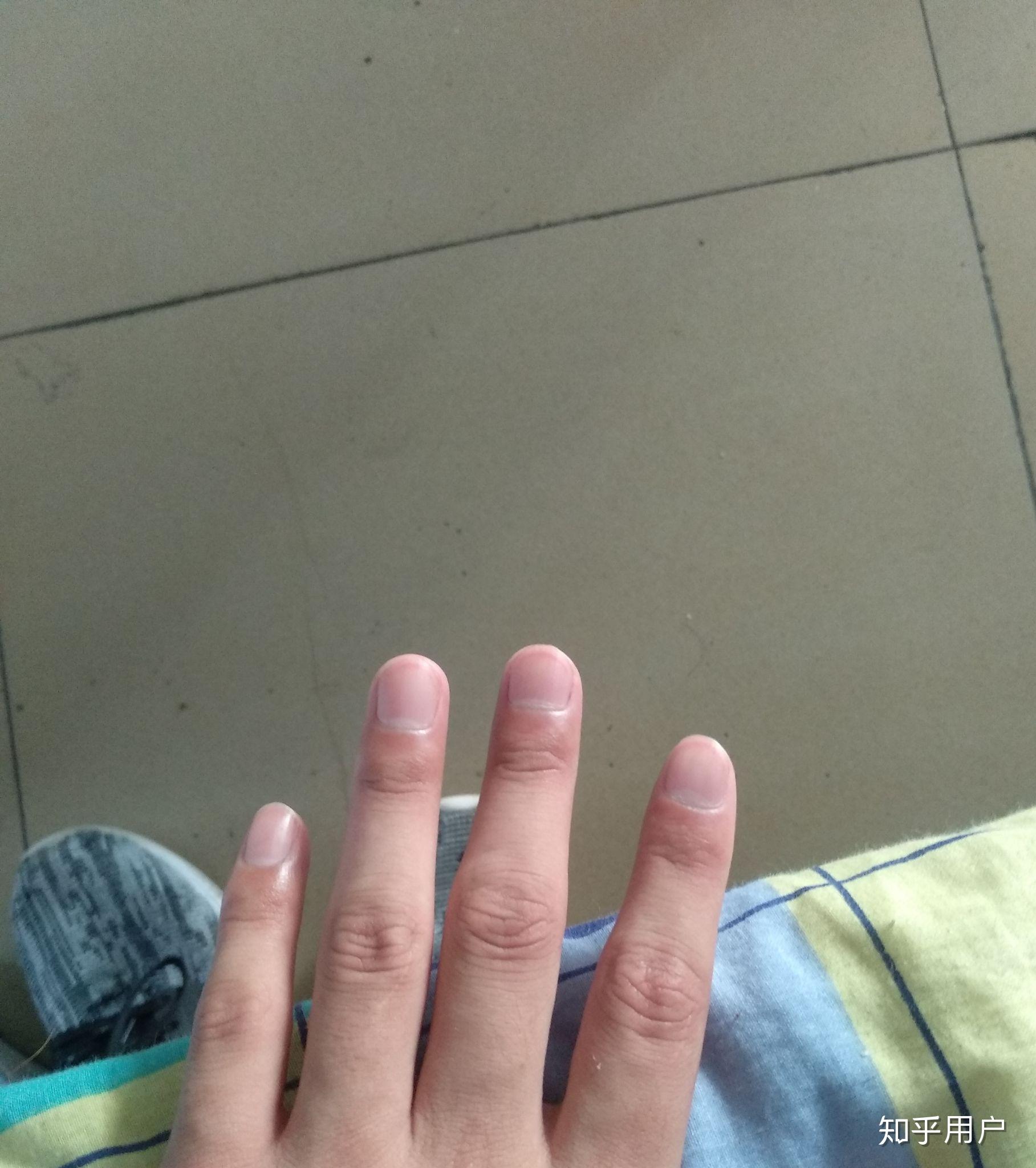 手指盖里面的月牙白能说明什么问题吗