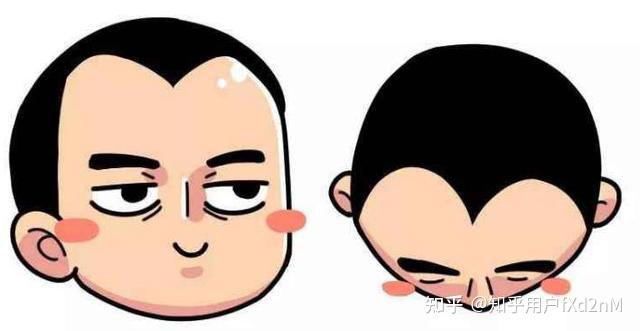 为什么额角更容易脱发? - 知乎