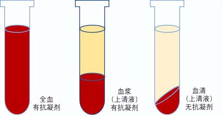 检测过程中,全血、血浆、血清哪种样本敏感性更高? - 知乎