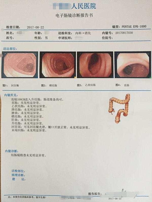 做腸鏡是種怎樣的體驗