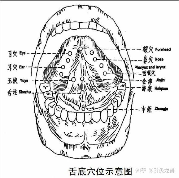 针灸治疗吞咽困难效果不佳的时候该怎么办?只能用舌三针和金津、玉液? - 知乎