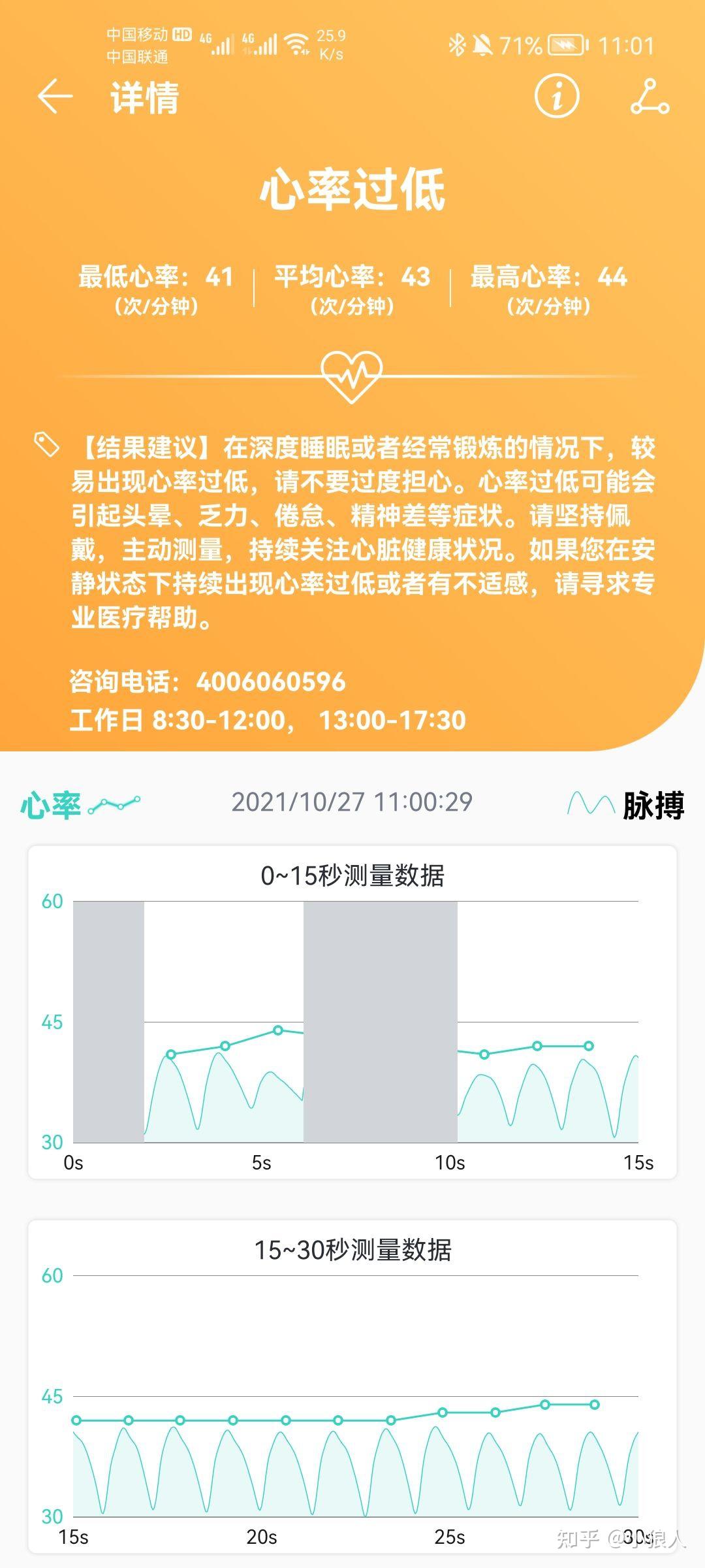 手环的心率测量准确吗静息心率咋这么低有点害怕