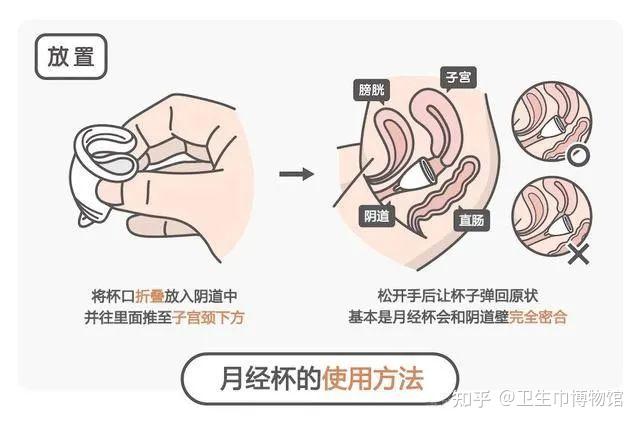 姨妈杯 步骤图片