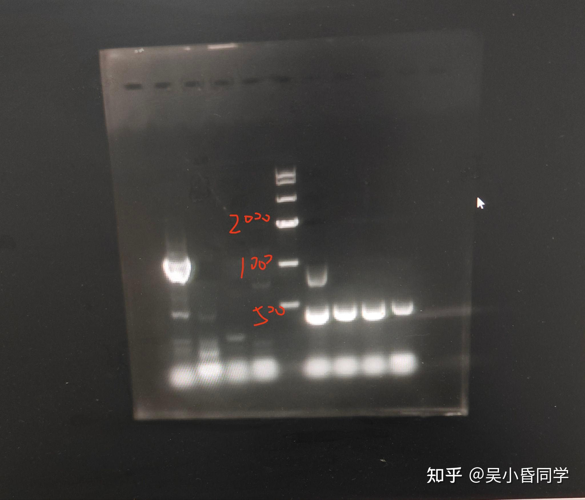 PCR扩增cDNA,条带弥散,求原因? - 知乎