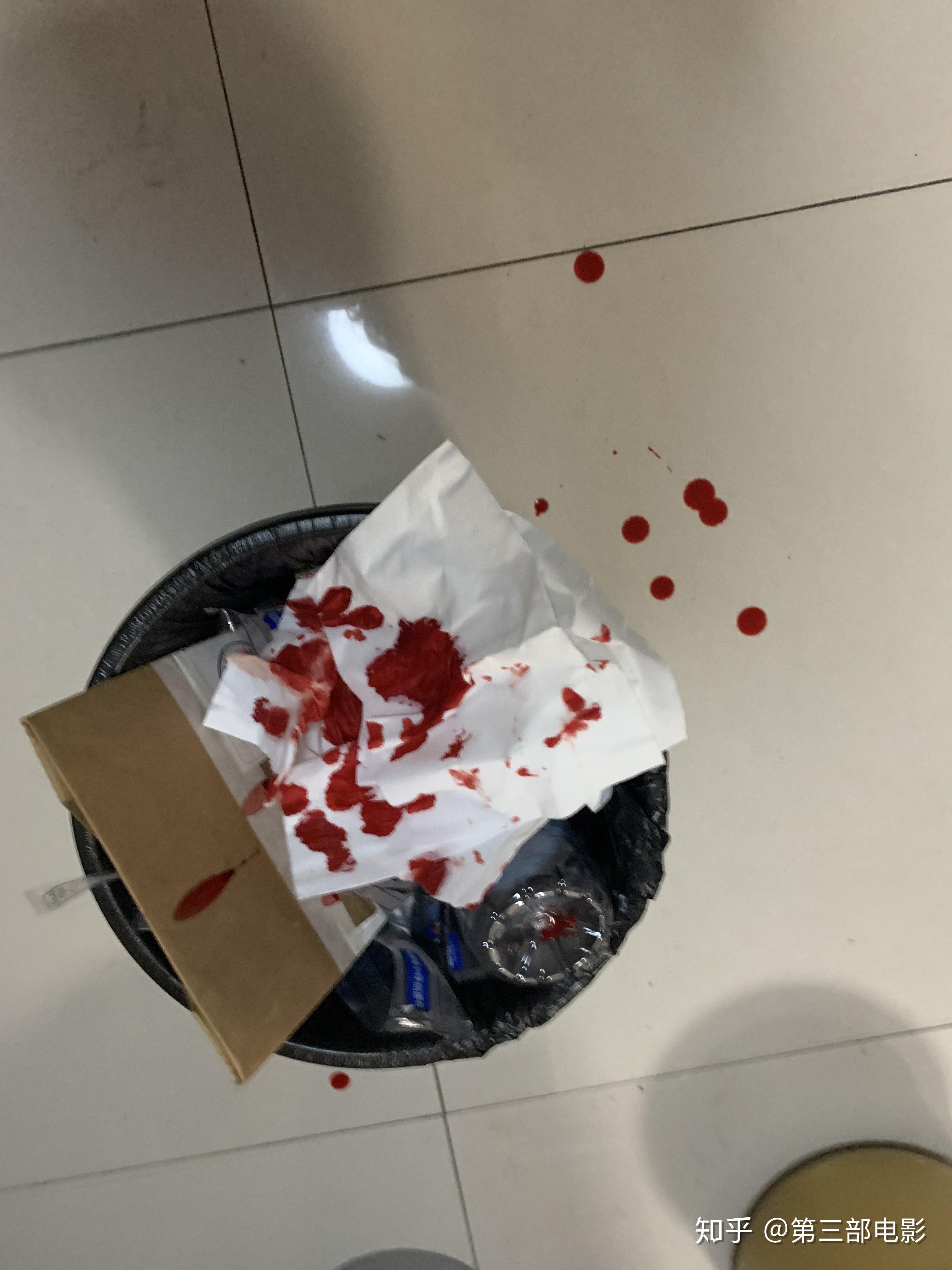 手指被割掉一块肉是什么体验? - 知乎