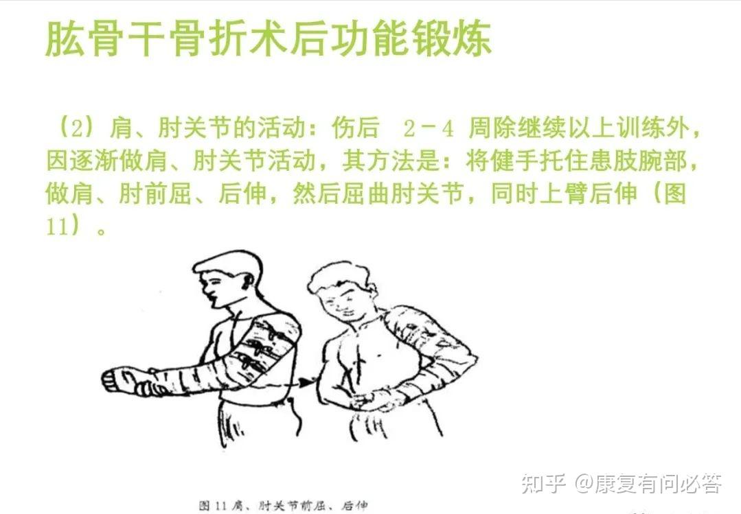 谁能介绍下骨科疾病的常见康复项目?