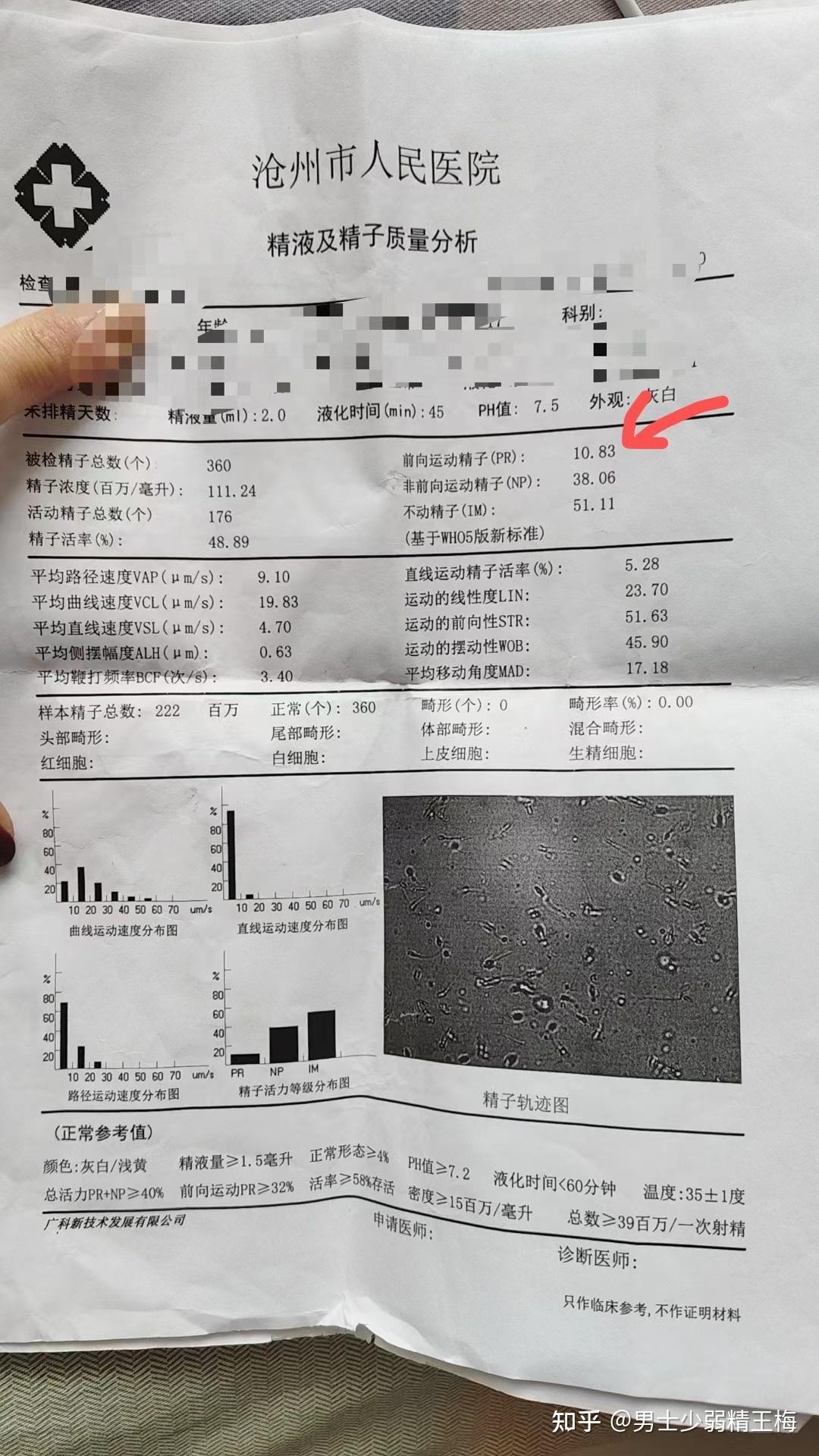 都调一年了,精子质量还是很差,弱精真能改善吗?