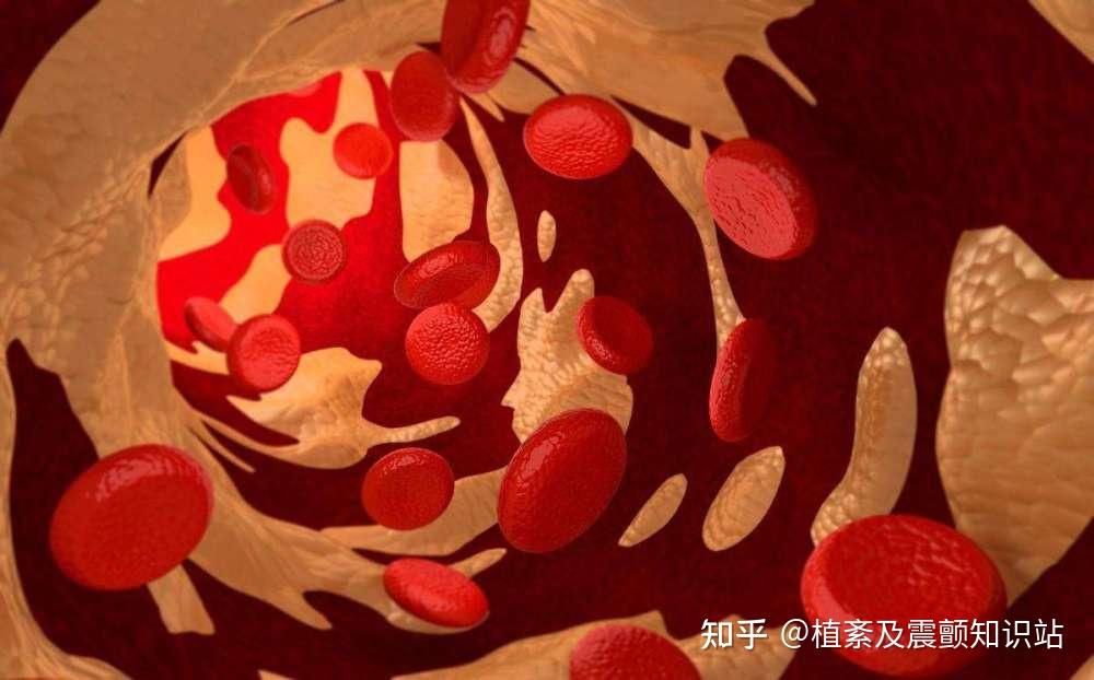 浑身乏力,气血亏虚或脾虚湿困?中药调理效果好? - 知乎