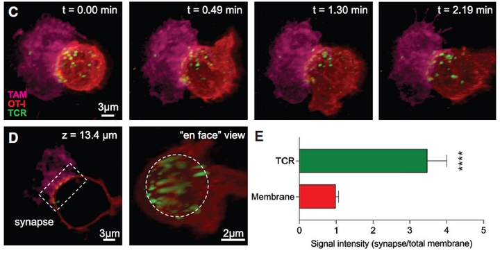 【cancer Cell】3i晶格光片显微镜揭示肿瘤相关巨噬细胞和耗竭cd8 T细胞之间的时空关联性 知乎