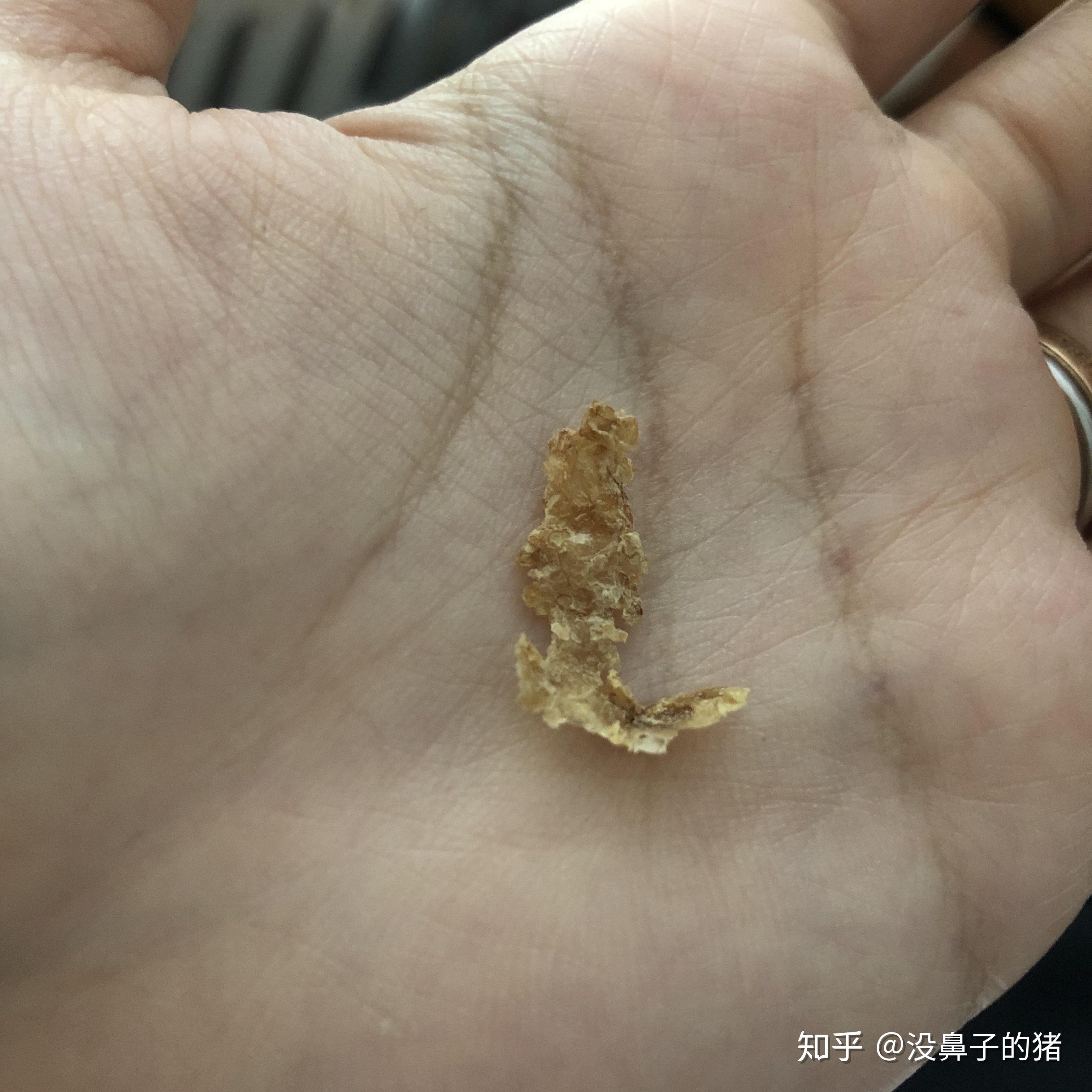 耳屎的成分 知乎