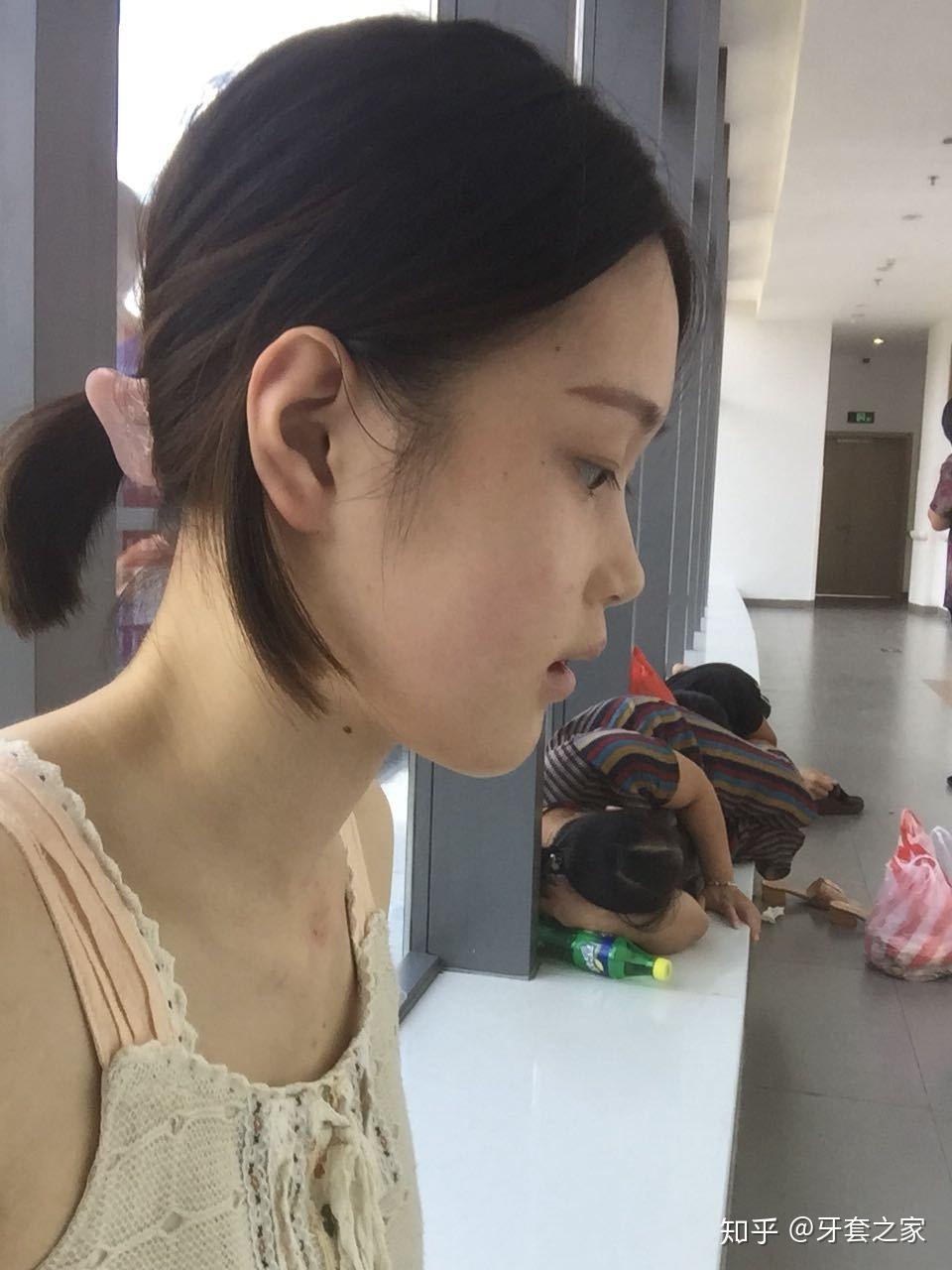 翘下巴月亮脸鞋拔子脸是不是很丑