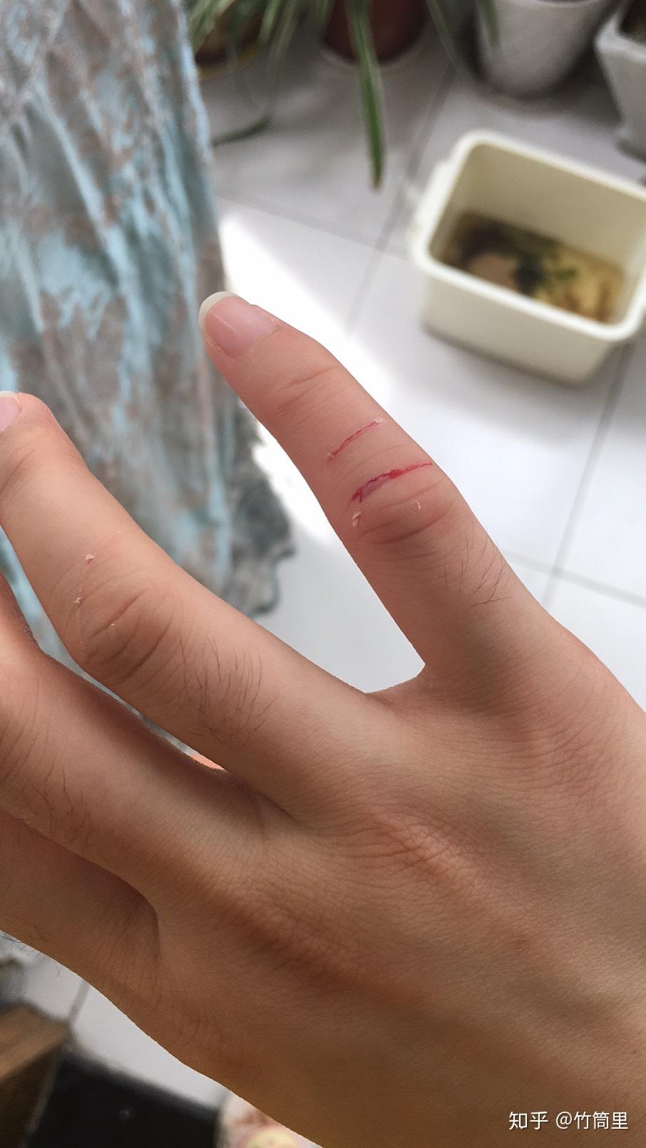 被自己养的猫咪抓伤了,破皮了,该怎么处理? - 知乎