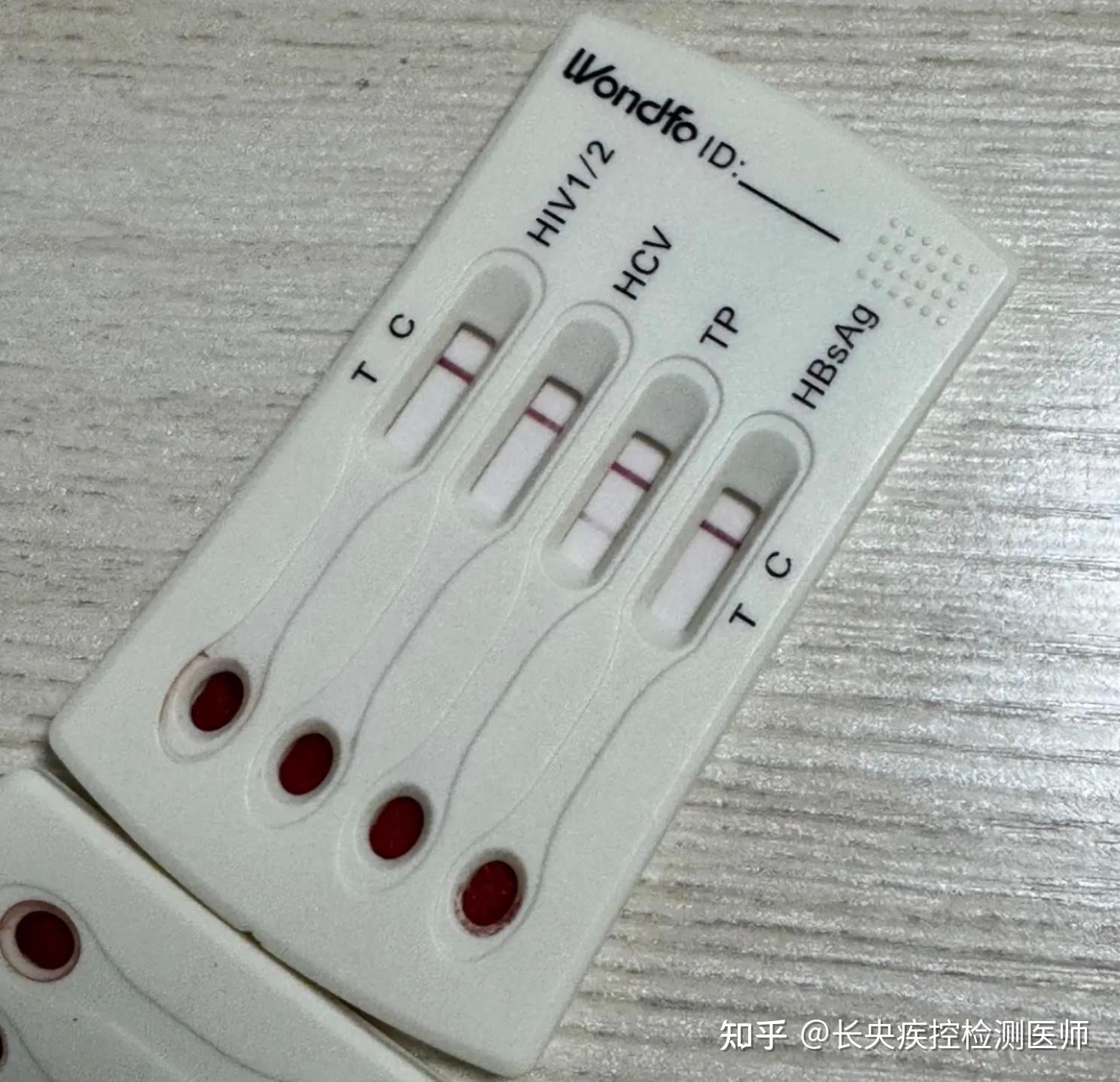 万孚试纸包埋线