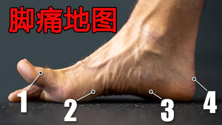 一张脚痛地图，教你自查55种疾病 - 知乎