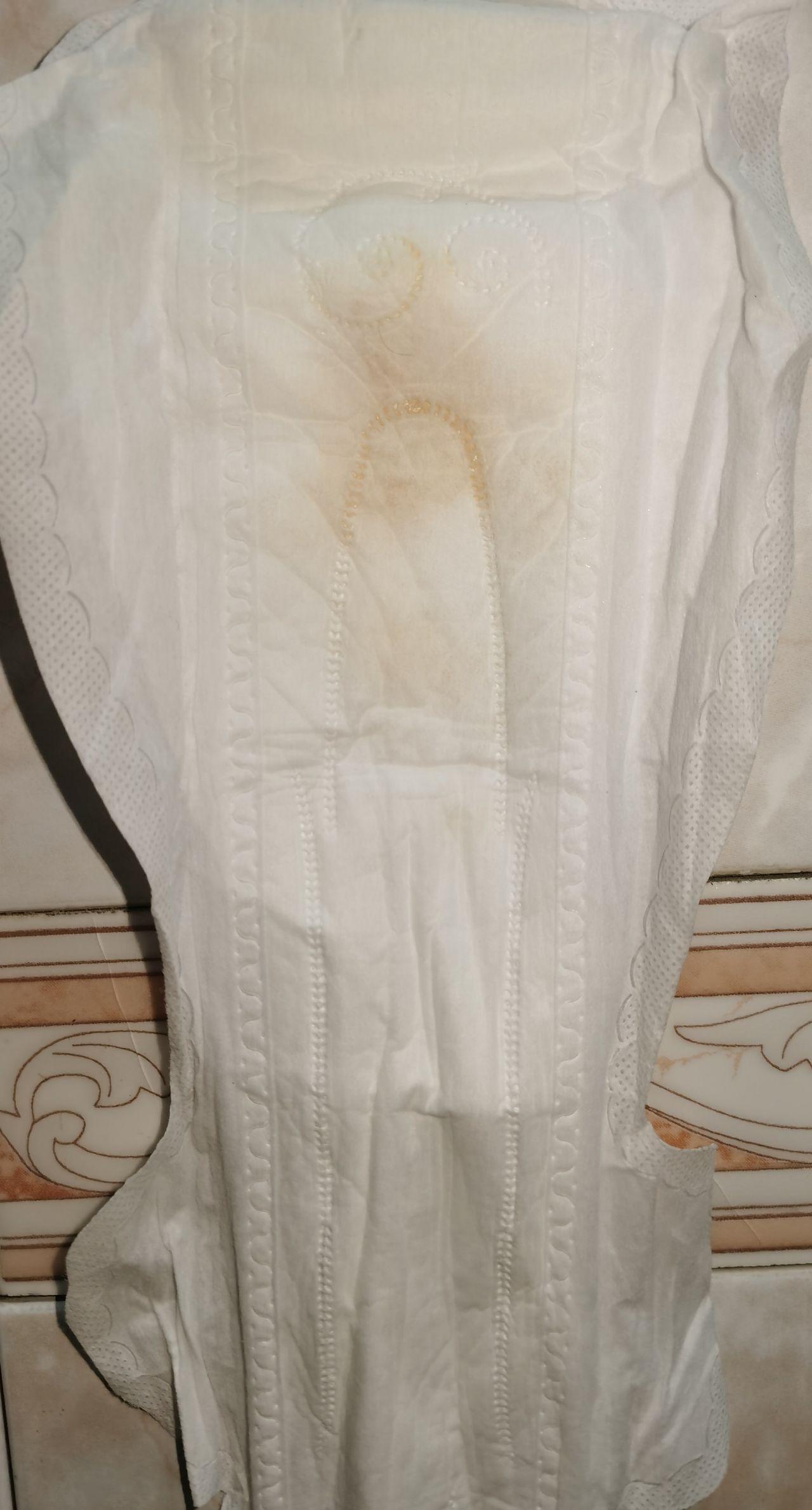 白带异常的多裤头都湿透的那种没有不舒服这正常吗可以不管吗