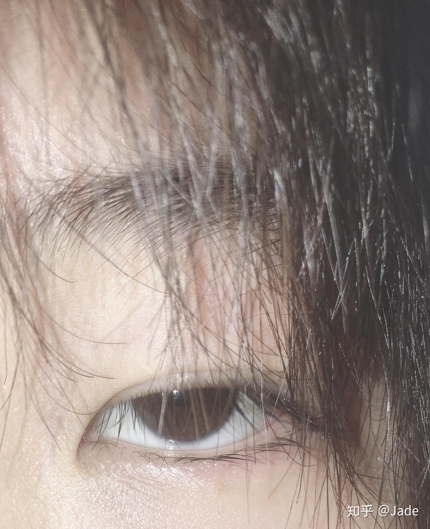 抑郁症患者的眼睛是什么样的