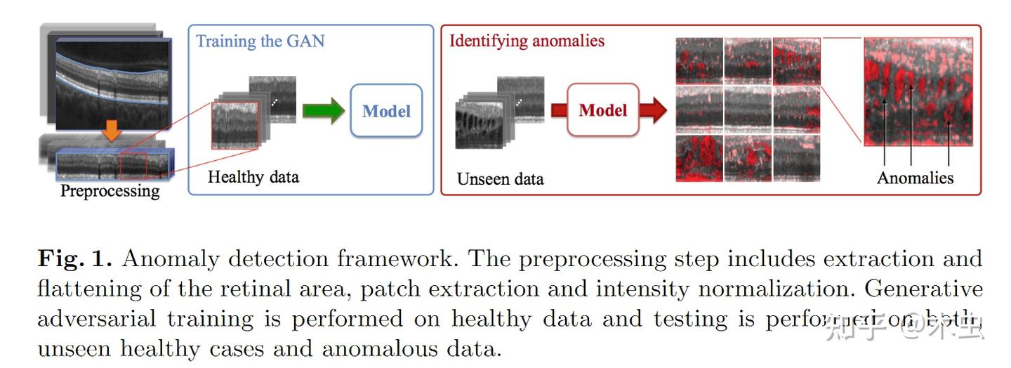 Unsupervised Anomaly Detection with Generative Adversarial Networks to ...