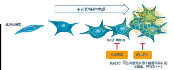 真实世界研究告诉你:治疗特发性肺纤维化(ipf),吡非尼酮vs尼达尼布