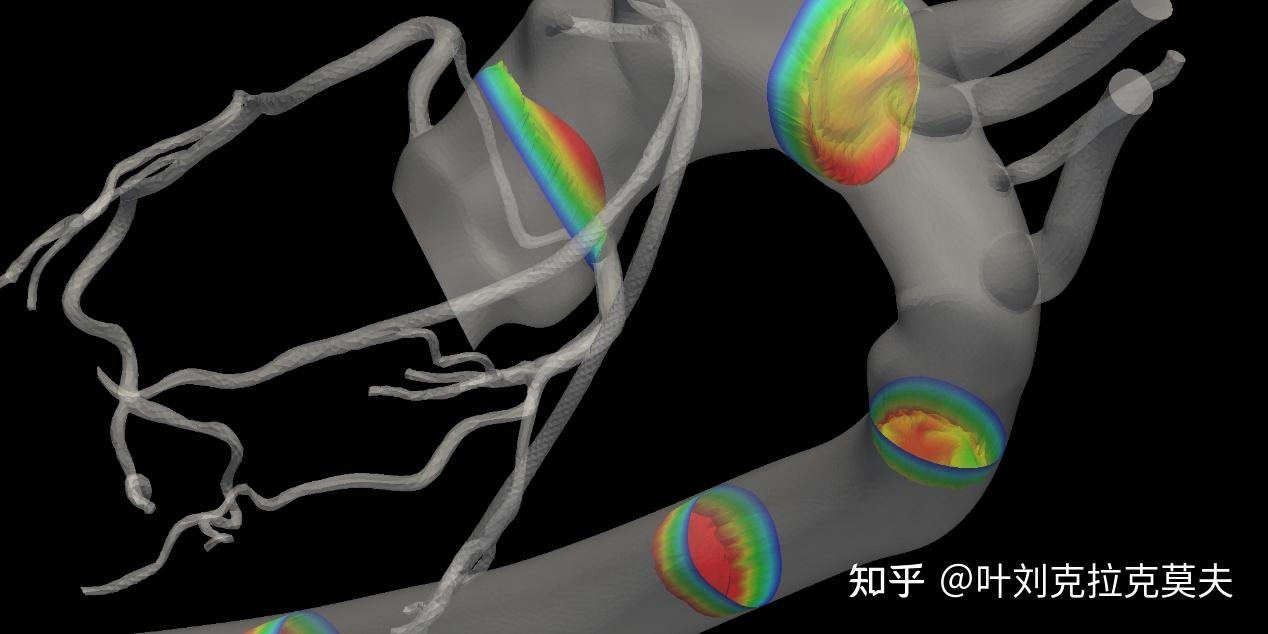 开源科学工程技术软件介绍63 – 血流模拟和分析软件Simvascular - 知乎