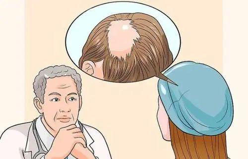 斑秃最有效的治疗方法图片