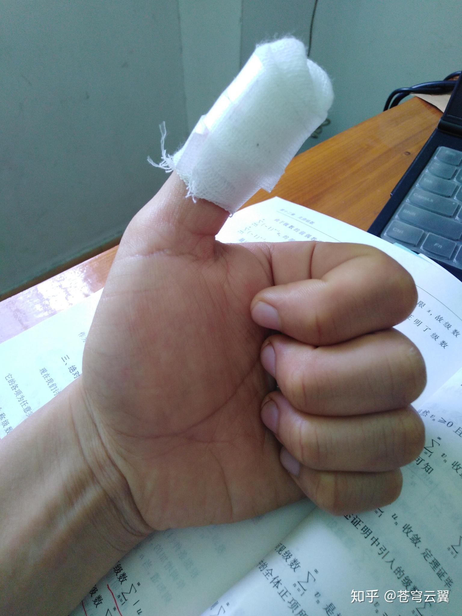 切菜时切到手是一种什么样的体验