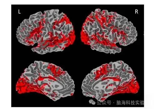 Hum Brain Mapp ：双语大脑如何分工？脑科学研究揭示语言表征奥秘 - 知乎