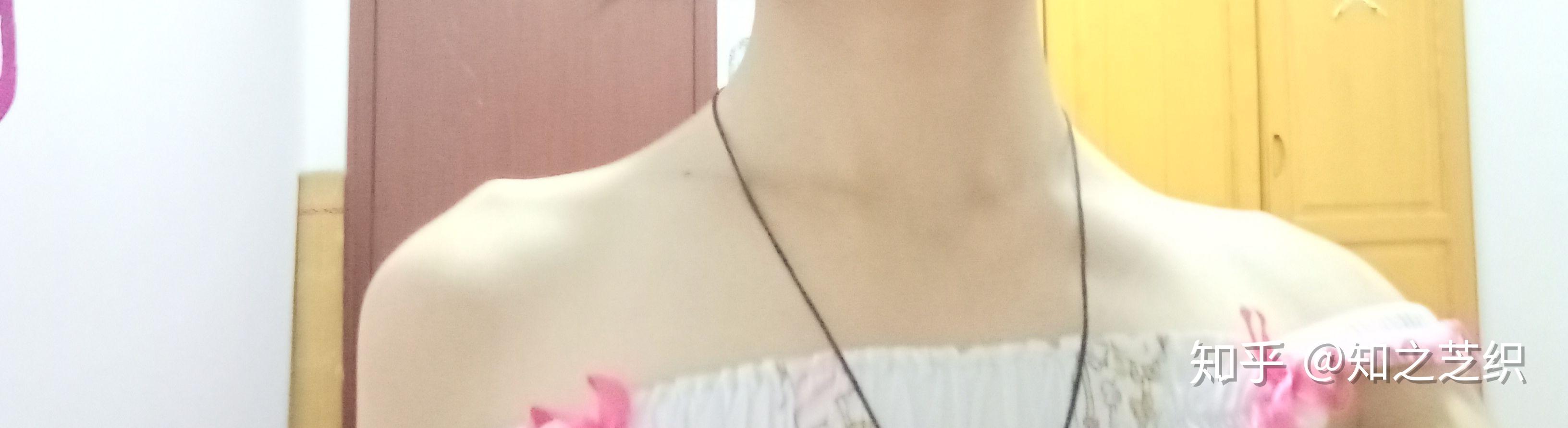 锁骨末端骨头凸起天生