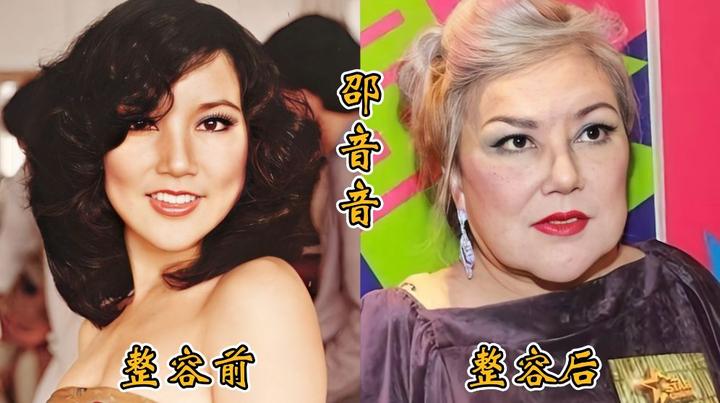 18位女明星整容前后对比,邵音音面目全非,杨颖堪称整容模板!