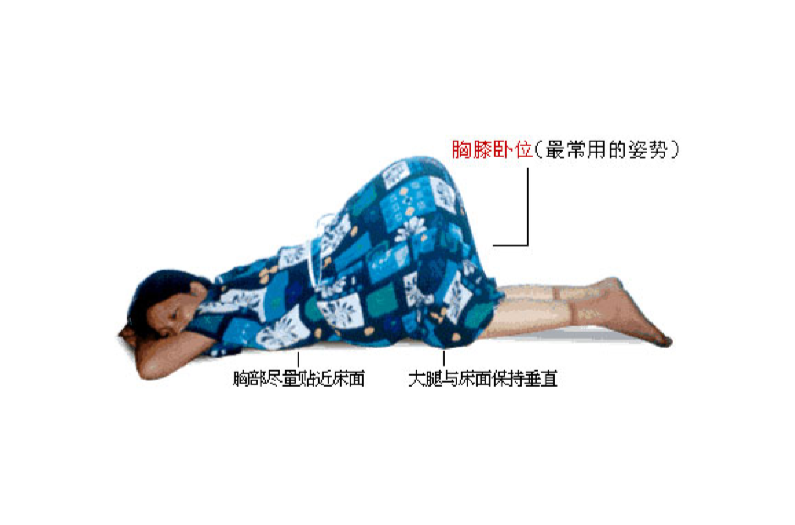 在痔疮手术的过程中应当保持一个什么样的体位或姿势
