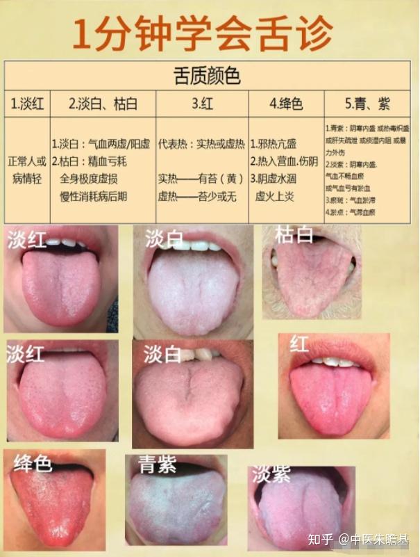 1分钟学会舌诊,老中医总结的心血,其实很简单,认真多看几遍,不会也会了!!! - 知乎