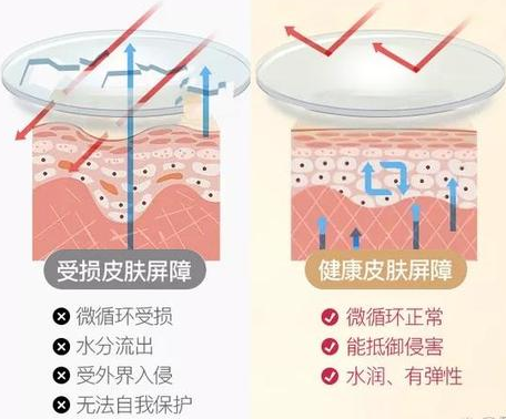 第3步:舒缓泛红,修复受损屏障