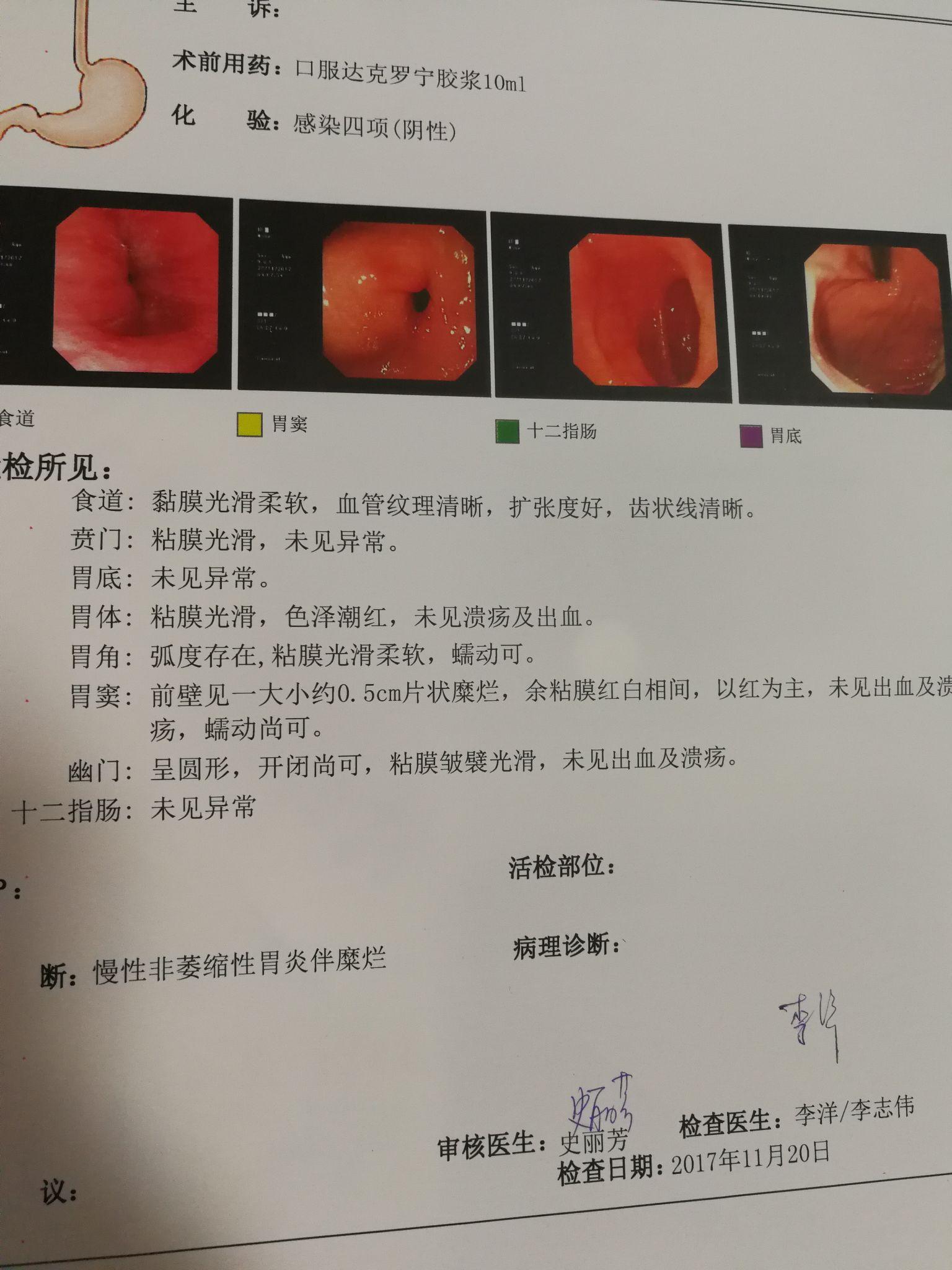 慢性非萎缩性胃炎伴糜烂能治好吗日常饮食有什么禁忌吗