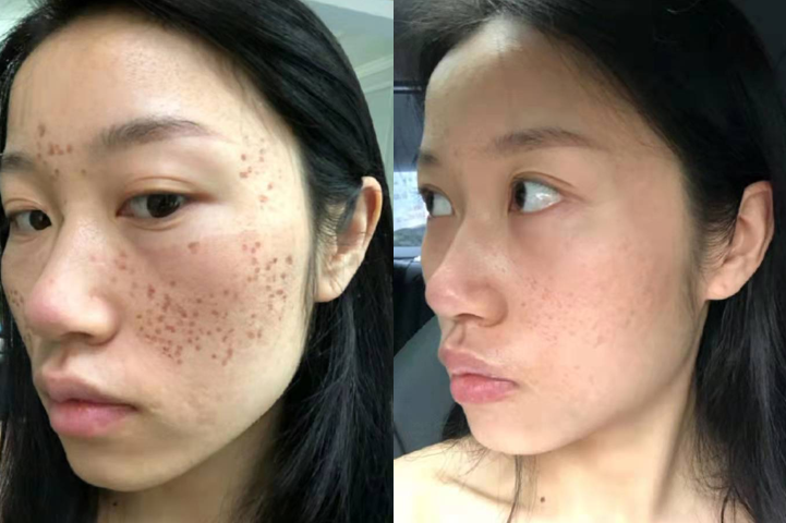 BrandImg